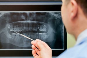 Curso de Diagnóstico e Planejamento em correções dento-maxilares